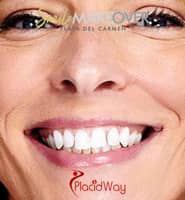 Slider image (2) Smile Makeover Playa Del Carmen